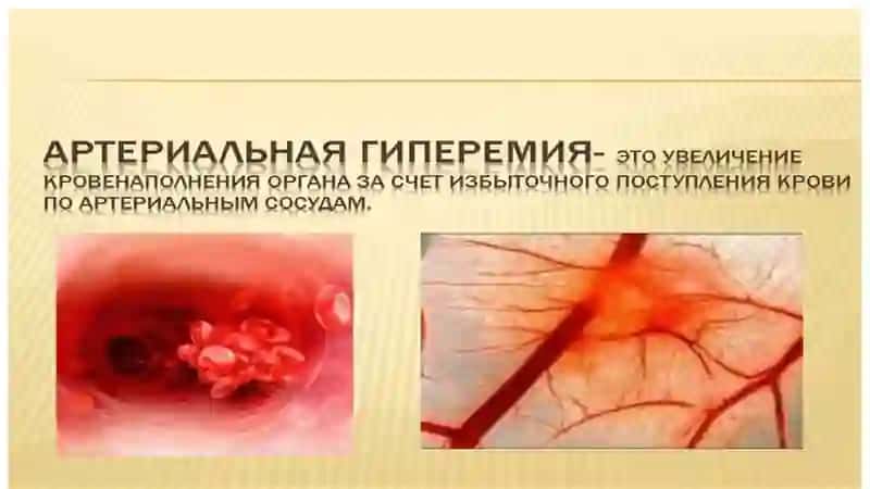 Arterial va venoz giperemiya 2