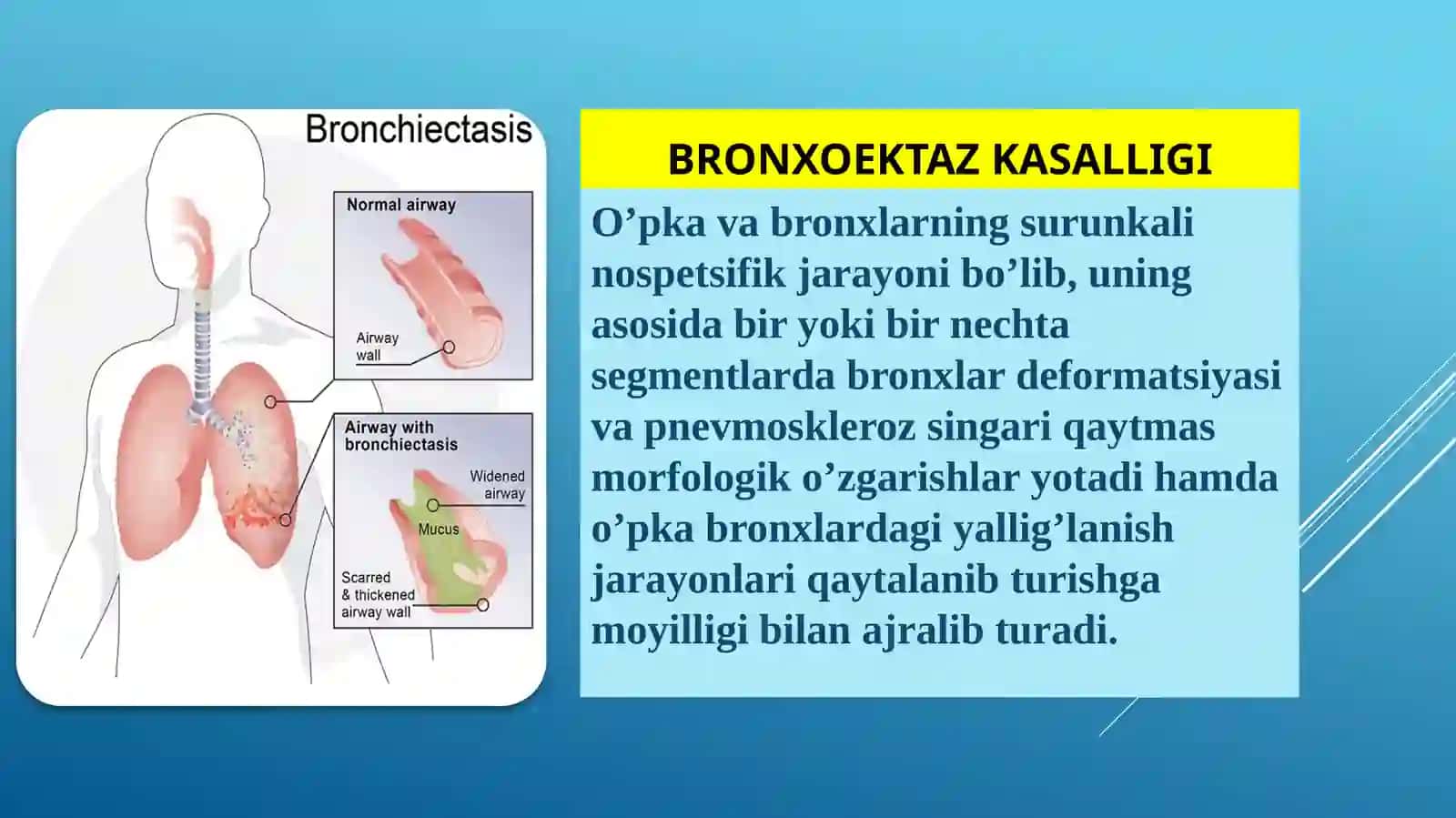 Bronxoektaz kasalligi 2