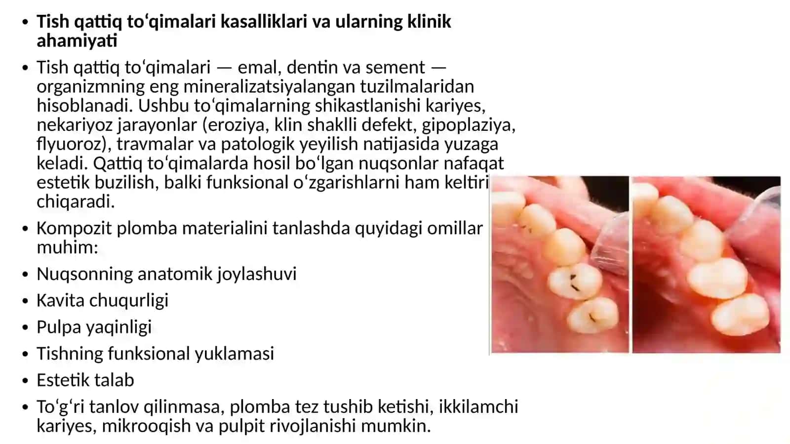 TISH QATTIQ TO’QIMALARI KASALLIKLARIDA NUQSONNING JOYLASHUVI VA CHUQURLIGIGA QARAB PLOMBA KOMPAZIT ASHYOLARNI TANLASH MEZONLARI 2
