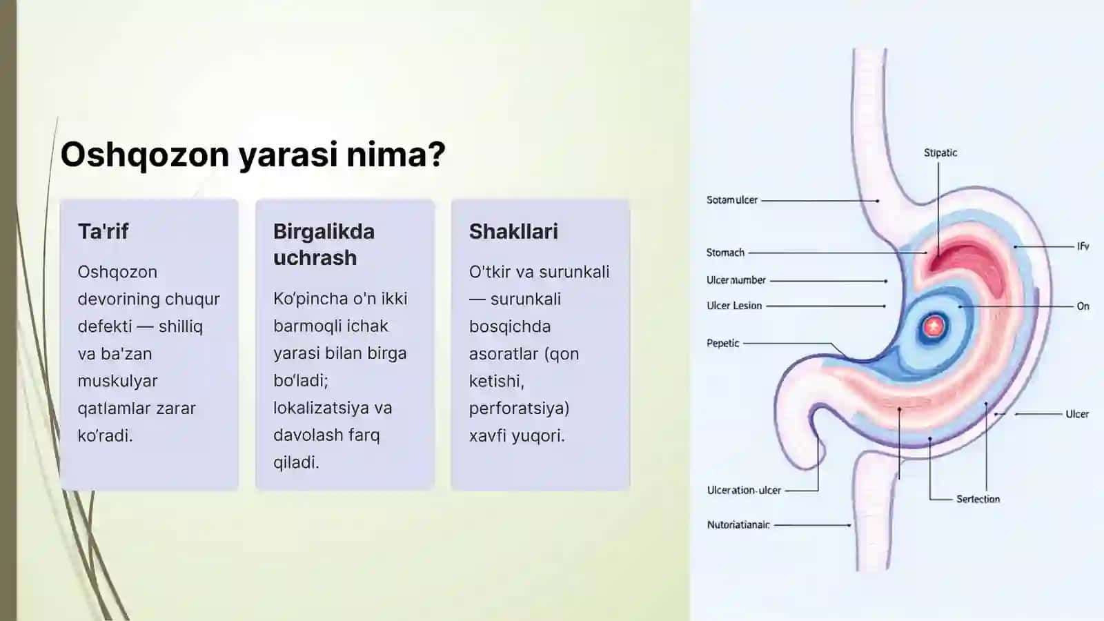 Oshqozon va o'n ikki barmoqli ichak yara kasalligi: Asoratlar va Diagnostika 2