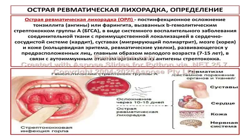 Симптоматология ревматической лихорадки и первичного ревмокардита 2