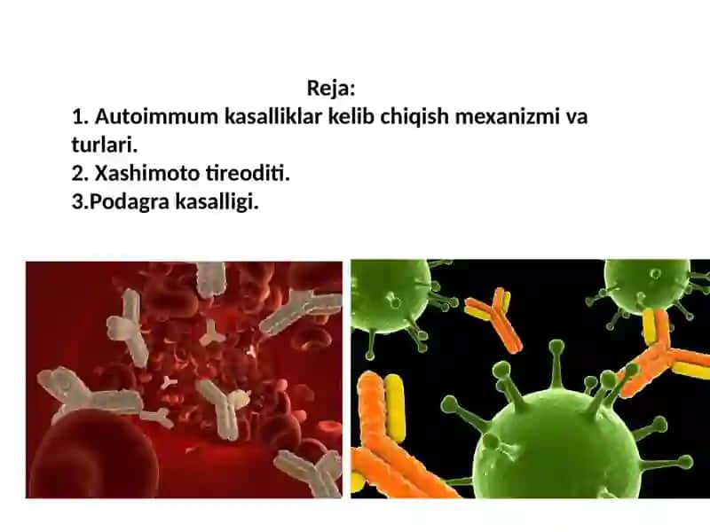 Autoimimmun kasalliklar 2