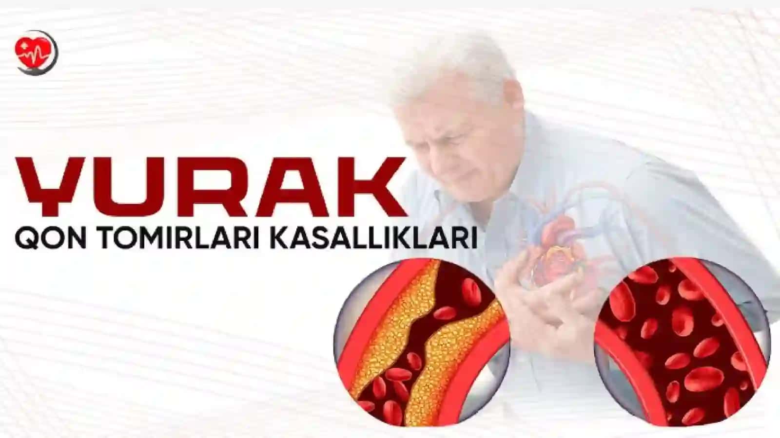 Yurak qon-tomir kasalliklarida ogʻiz boʻshligʻi shilliq qavatini oʻzgarishlari 2