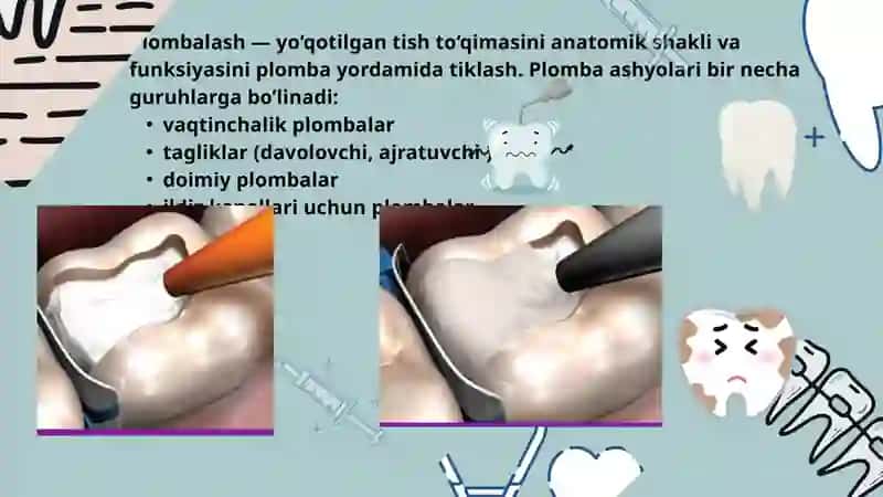 Plomba ashyolarining tasnifi 1-qism 2