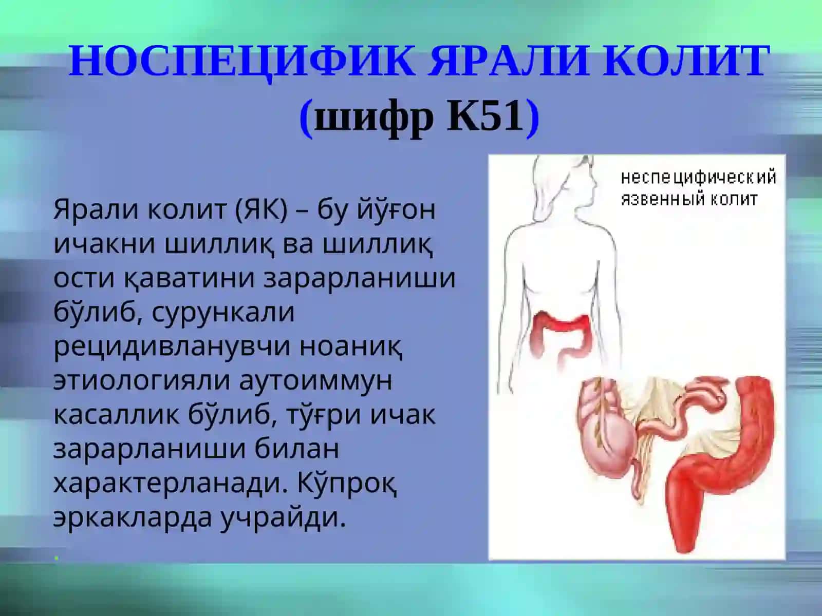 НОСПЕЦИФИК ЯРАЛИ КОЛИТ (шифр К51) 2