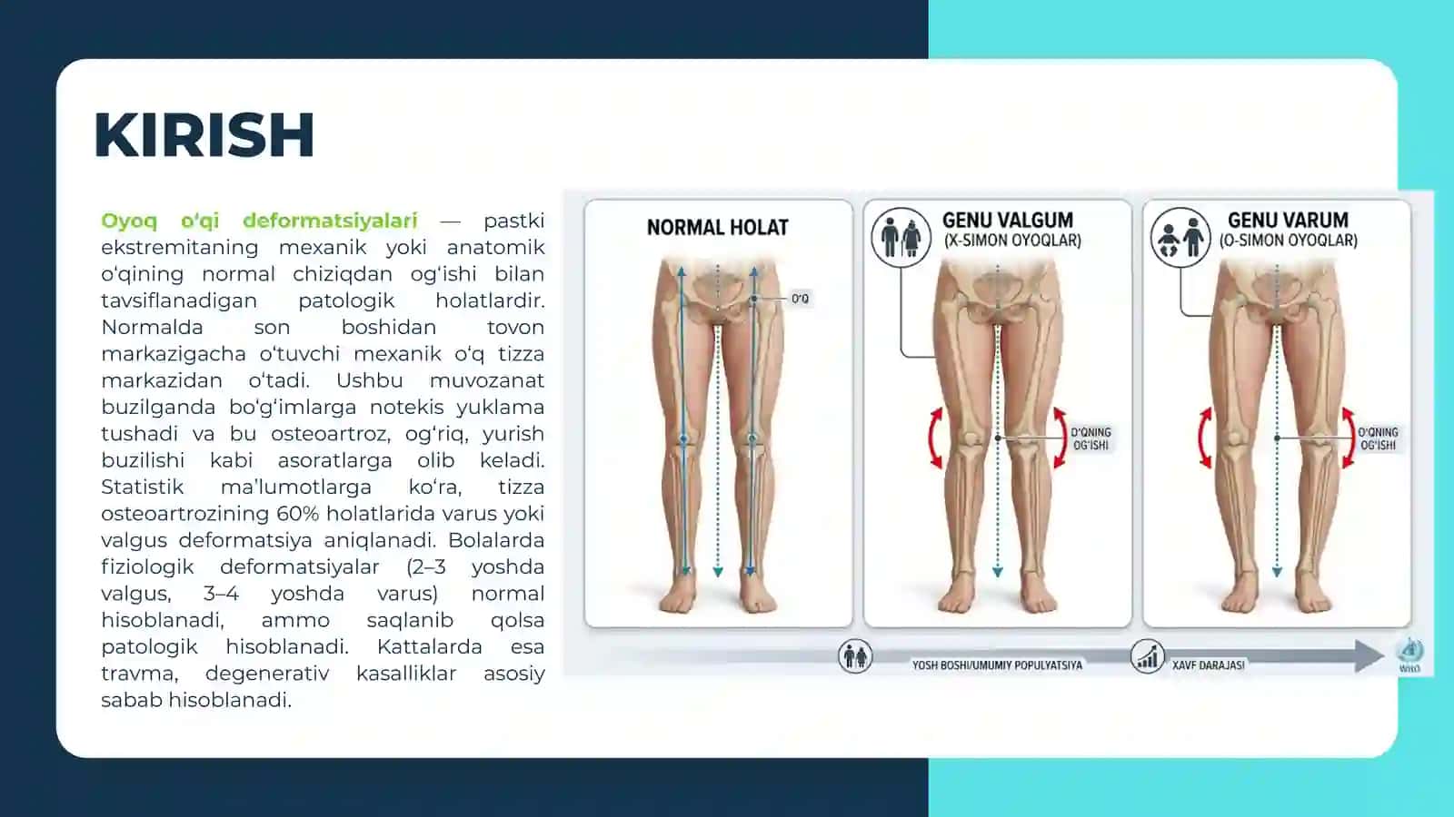 Oyoq o‘qi deformatsiyalari 2