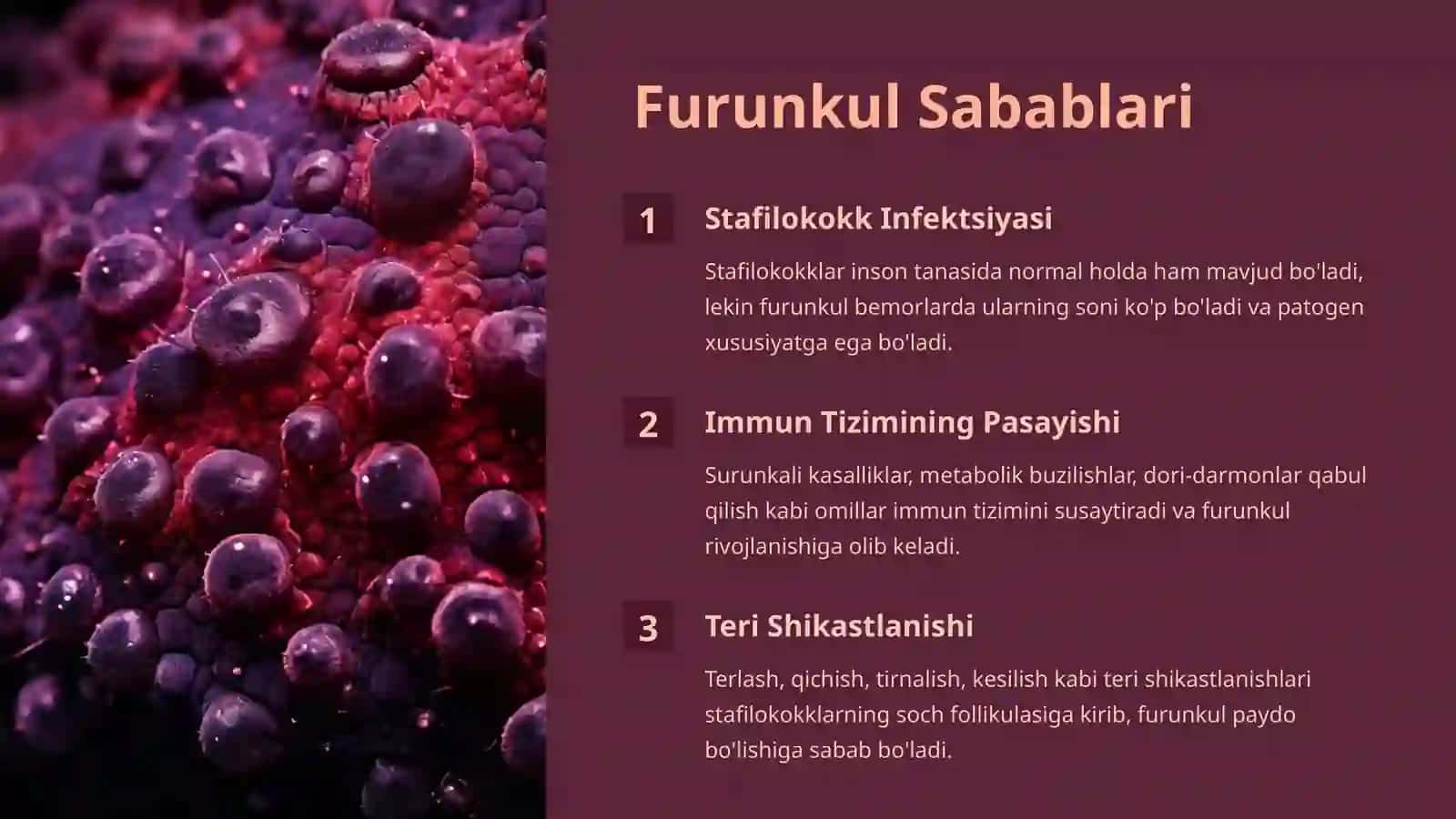 Furunkul (Chipqon) — Sabablari, Asoratlari, Tashxislash, Davolash, Oldini Olish 2