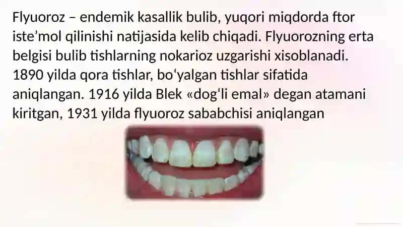 Bolalarda Emal Fluorozi 2