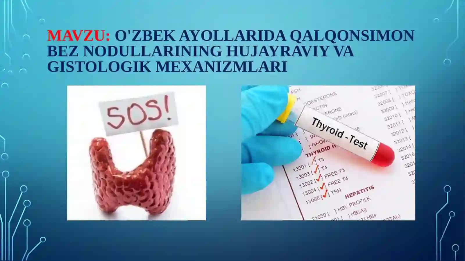 Qalqonsimon bez nodullari 2