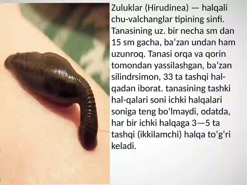 Zuluklar hamda ikki pallali molluskalar sinfi, tuzilishi, rivojlanishi, sistematikasi 2