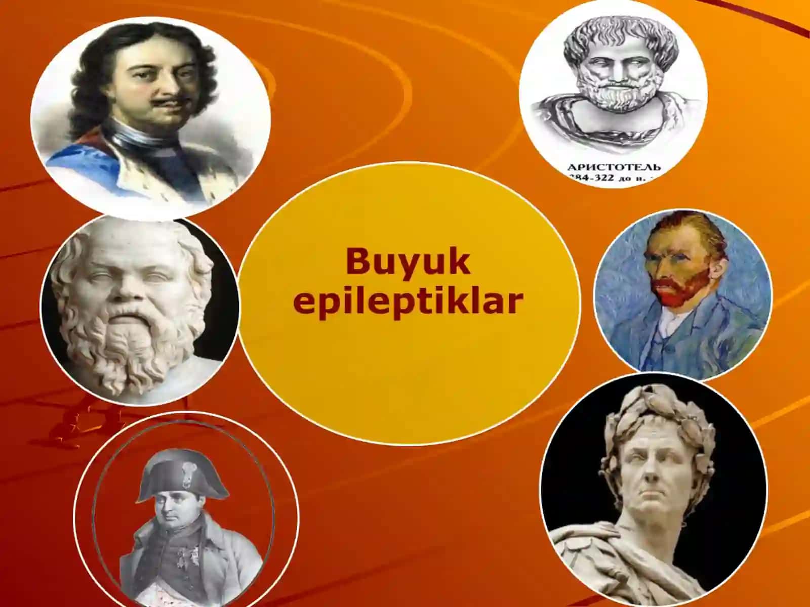 EPILEPSIYA VA TUTQANOQ SINDROMI 2