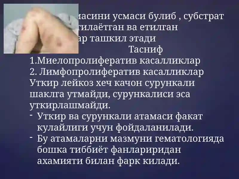 Surunkali leykozlar | Сурункали лейкозлар 2