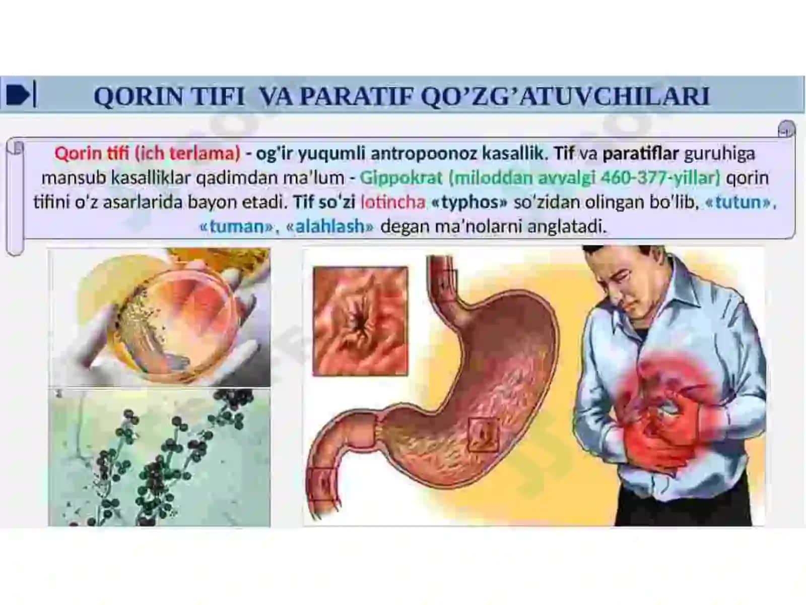 Qorin tifi va paratif A, V qoʻzgʻatuvchilari keltirib chiqaradigan kasalliklar tavsifi, profilaktikasi va laboratoriya tashxisi 2