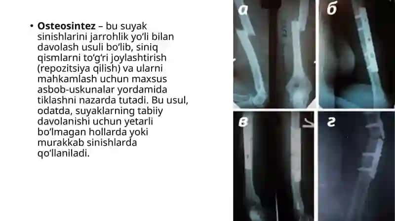 SUYAK SINISHI 2