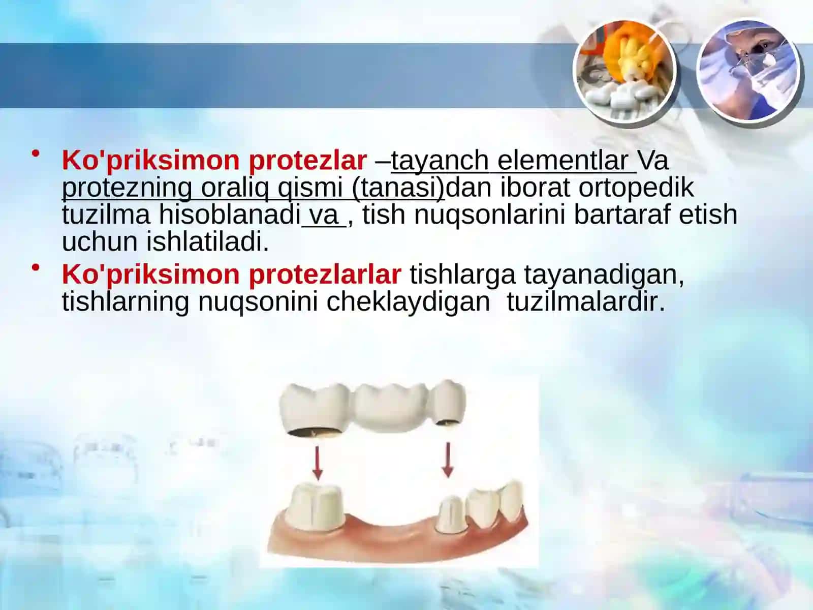 Qisman tish qatori nuqsonida ko‘priksimon protezlar bilan protezlash 2