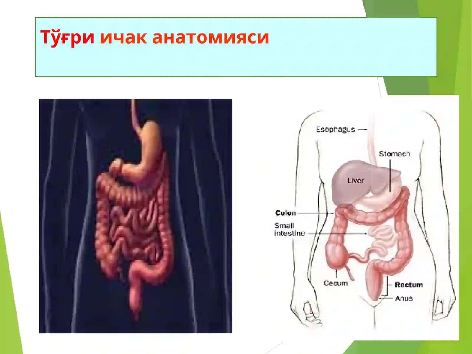 ТЎҒРИ ИЧАК КАСАЛЛИКЛАРИ 2