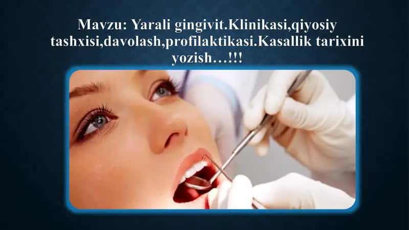 Yarali gingivit 2