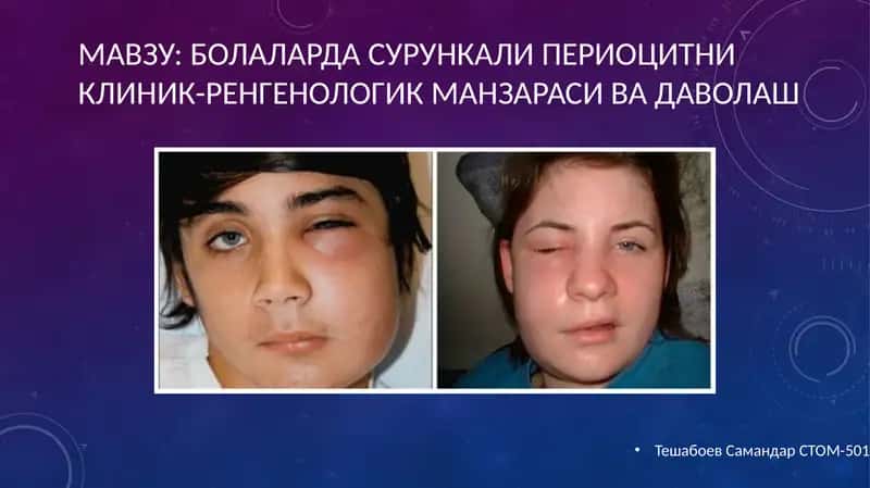 Болалар стоматологияси кафедраси 2