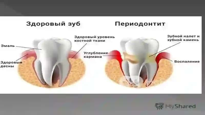 Klinik endodontiya fanidan tayyorlagan mustaqil ishi 2