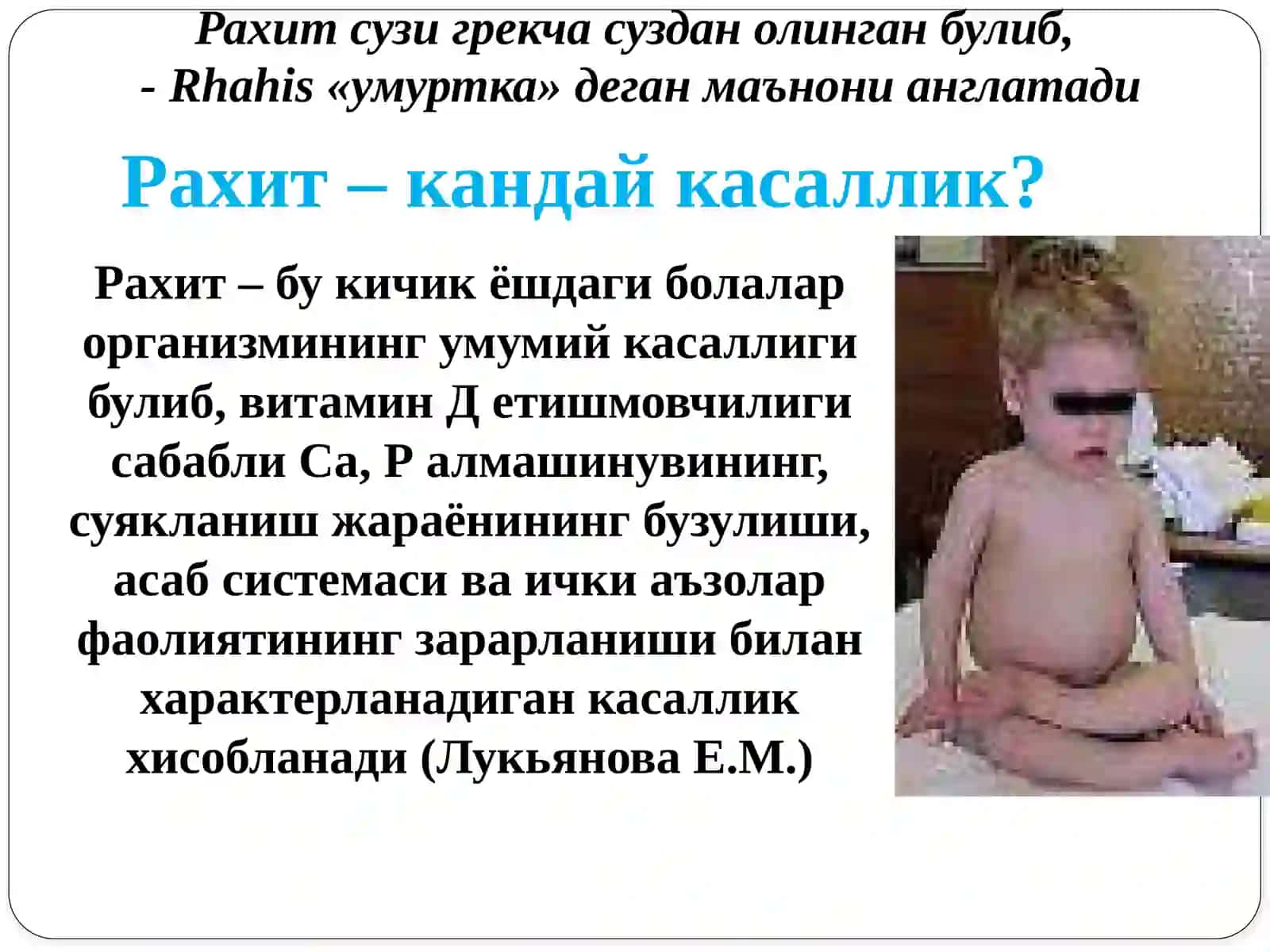 Рахит касаллиги 2