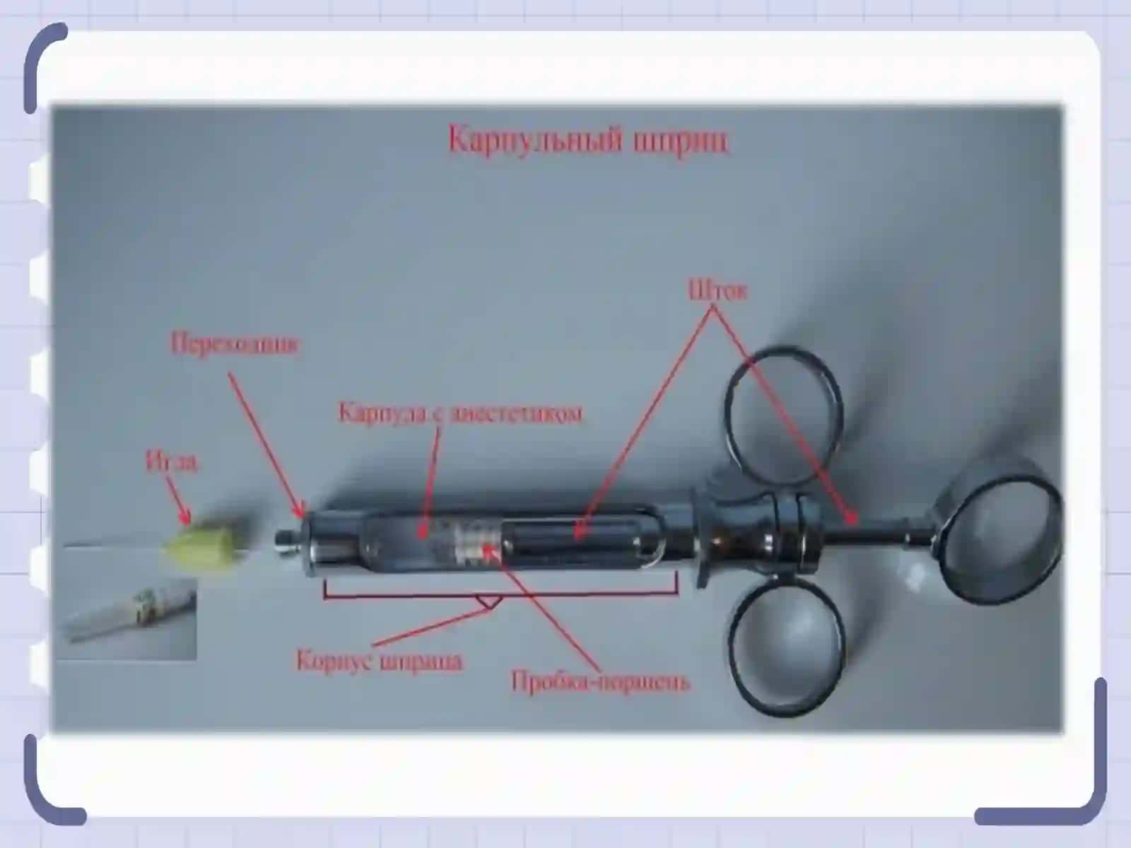 Xirurgik stomatologiyada ishlatiladigan anesteziya turlari 2
