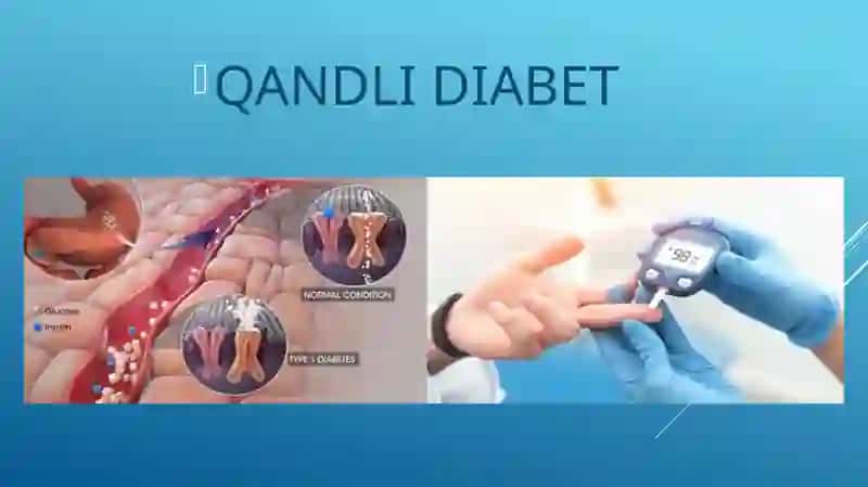 Qandli Diabet 2