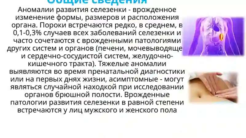 Аномалии развития селезенки 2