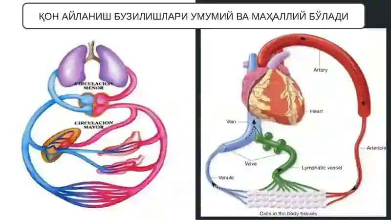 ҚОН АЙЛАНИШНИНГ БУЗИЛИШЛАРИ, ТРОМБОЗ, ИНФАРКТ, ҚОН ҚУЙИЛИШИ, ҚОН КЕТИШИ, ШОК 2
