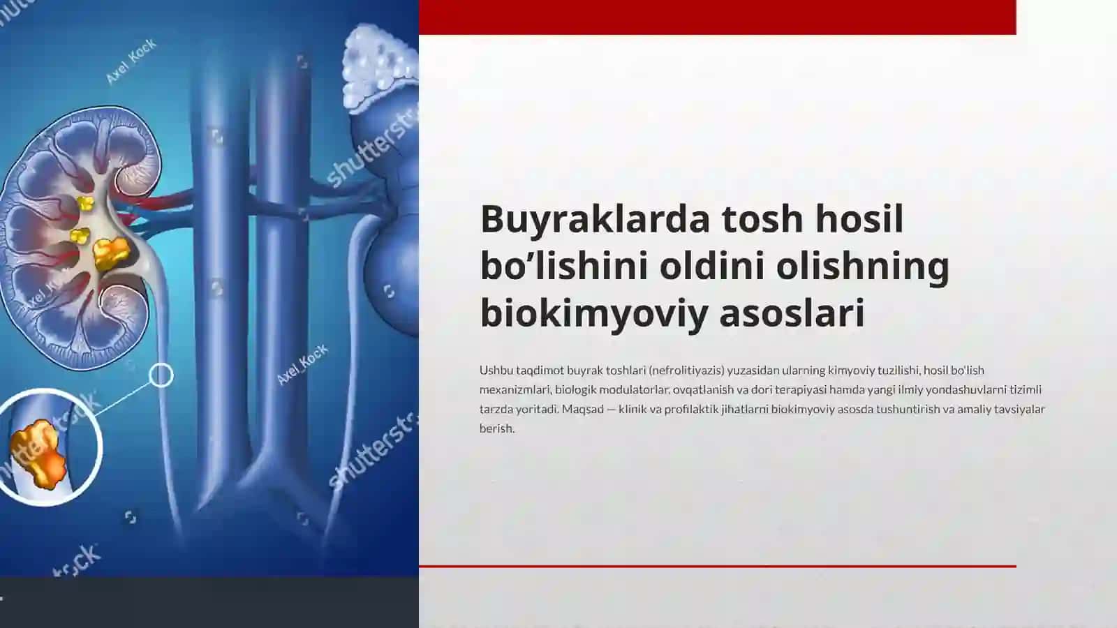 Buyraklarda tosh hosil bo’lishini oldini olishning biokimyoviy asoslari. 2