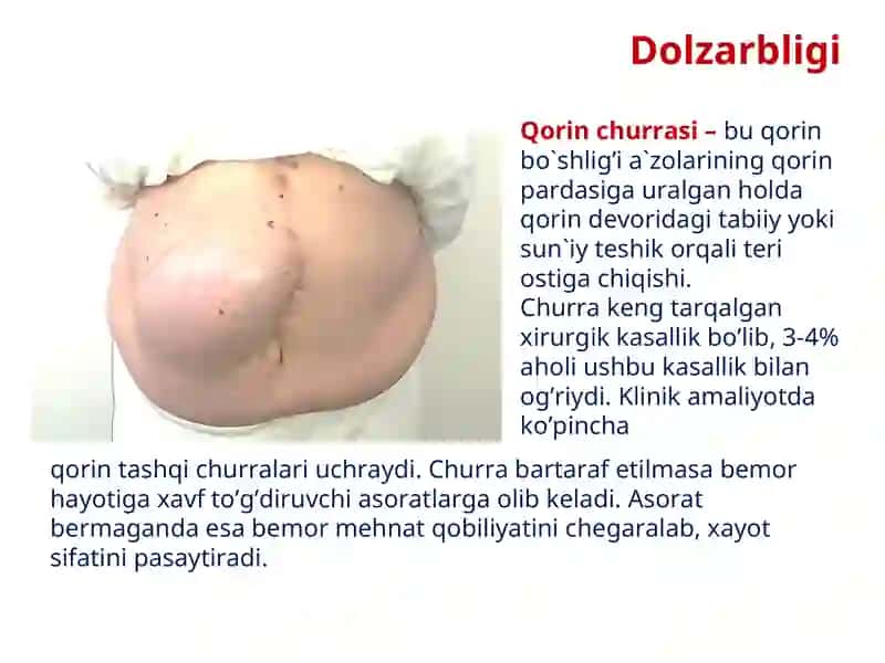 QORIN CHURRALARI 2