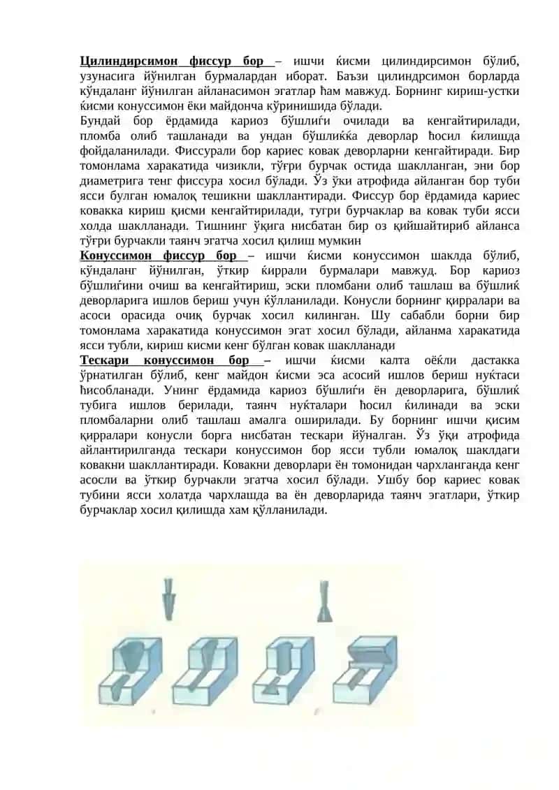 Тишларни чархлашда ишлатиладиган асбоблар 2
