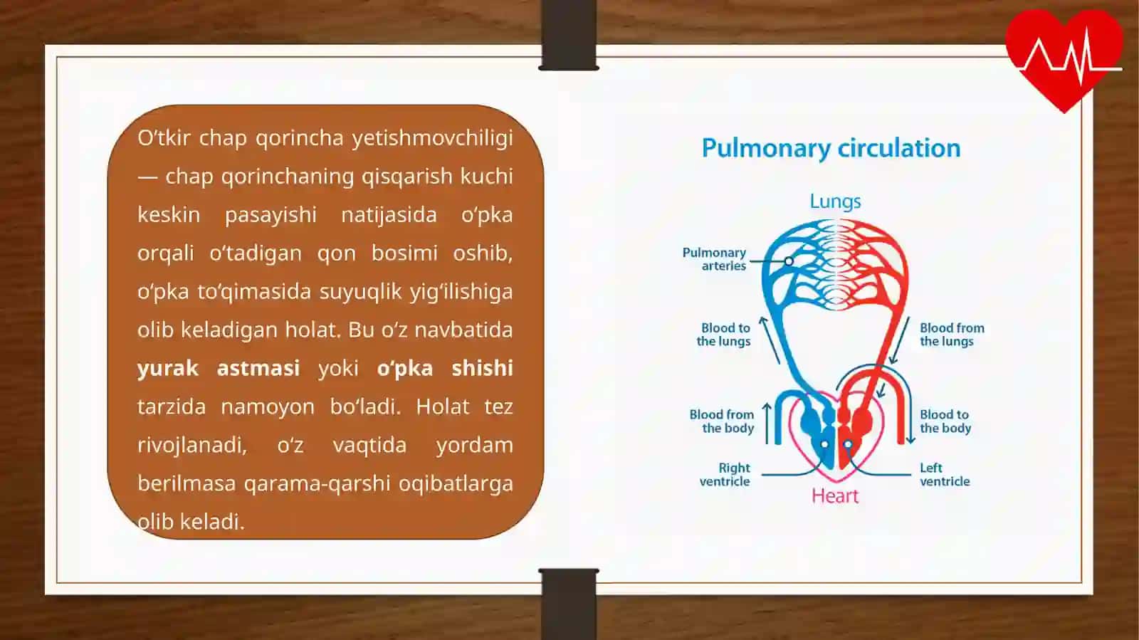 O‘TKIR CHAP QORINCHA YETISHMOVCHILIGI: YURAK ASTMASIVA O‘PKA SHISHI 2