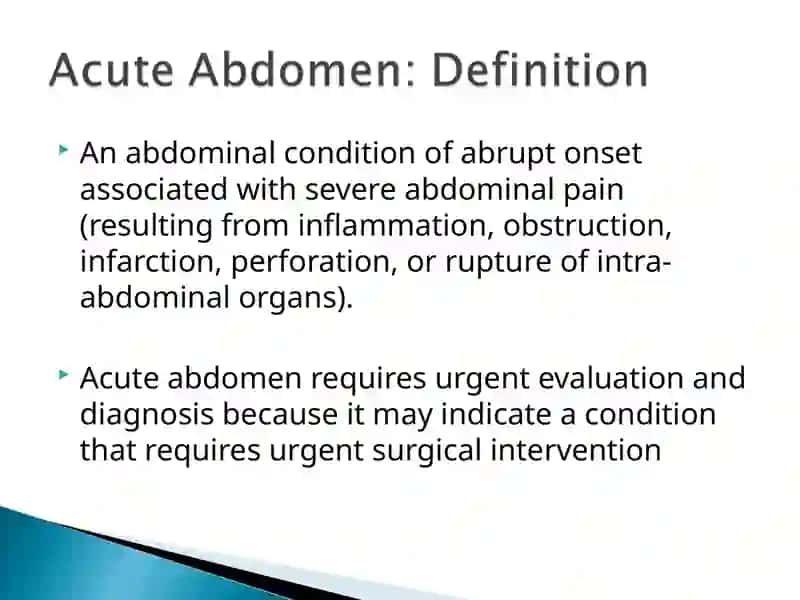 Acute abdomen 2