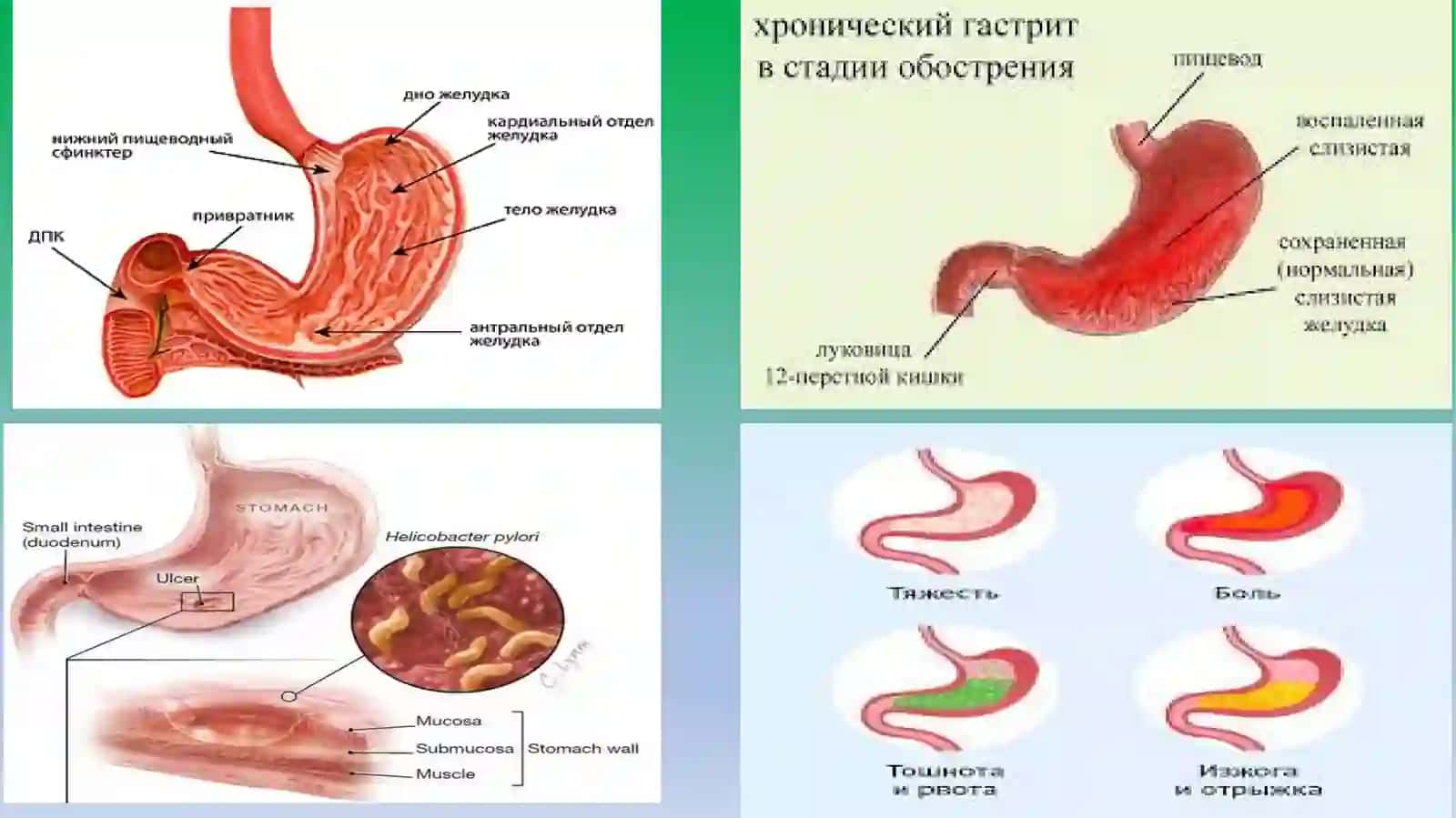 Ошқозон-ичак касалликлари ва оғиз бўшлиғидаги ўзгаришлар 2
