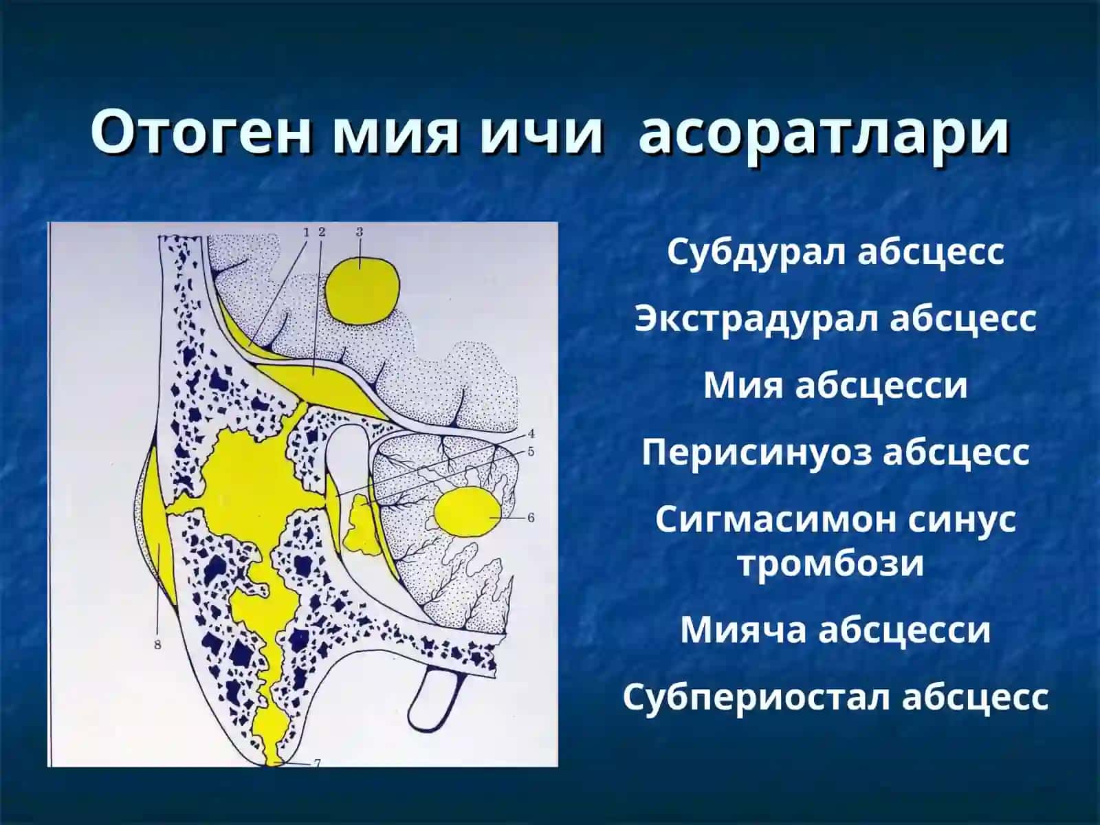 Отоген мия ичи асоратлари 2