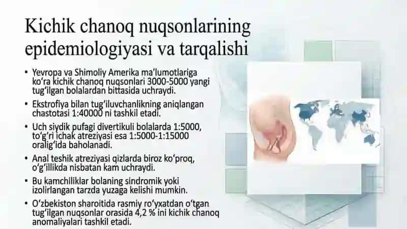 Kichik chanoq a'zolari tug'ma nuqsonlari ekstrofiya, siyodik pufaki divertikuli, to'g'ri ichak 2