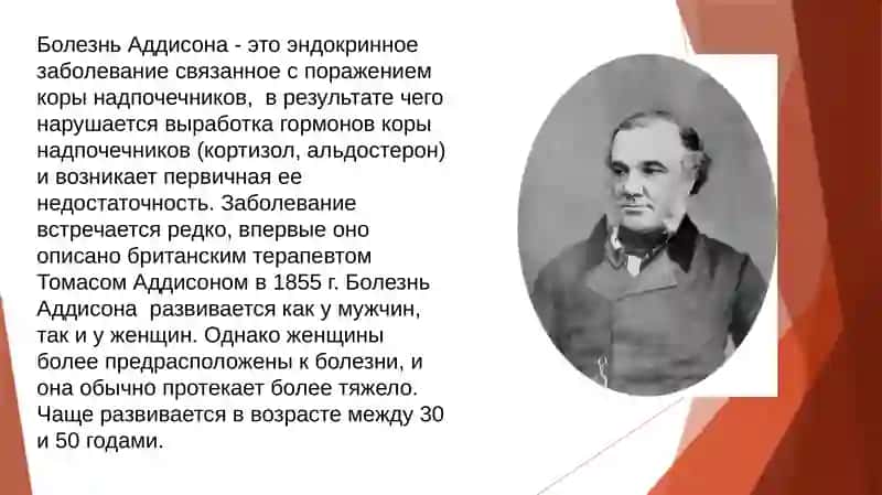 Бронзовая болезньили Болезнь Аддисона 2