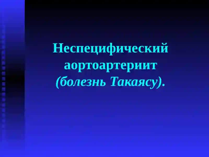 Неспецифический аортоартериит (болезнь Такаясу) 2