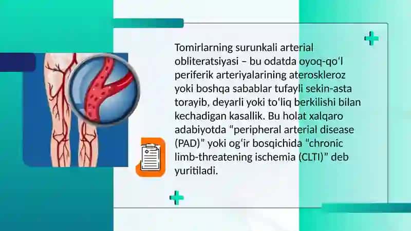 Tomirlarning surunkali arterial obliteratsiyasini davolashning zamonaviy usullari/Современные методы лечения хронической артериальной облитерации сосудов 2