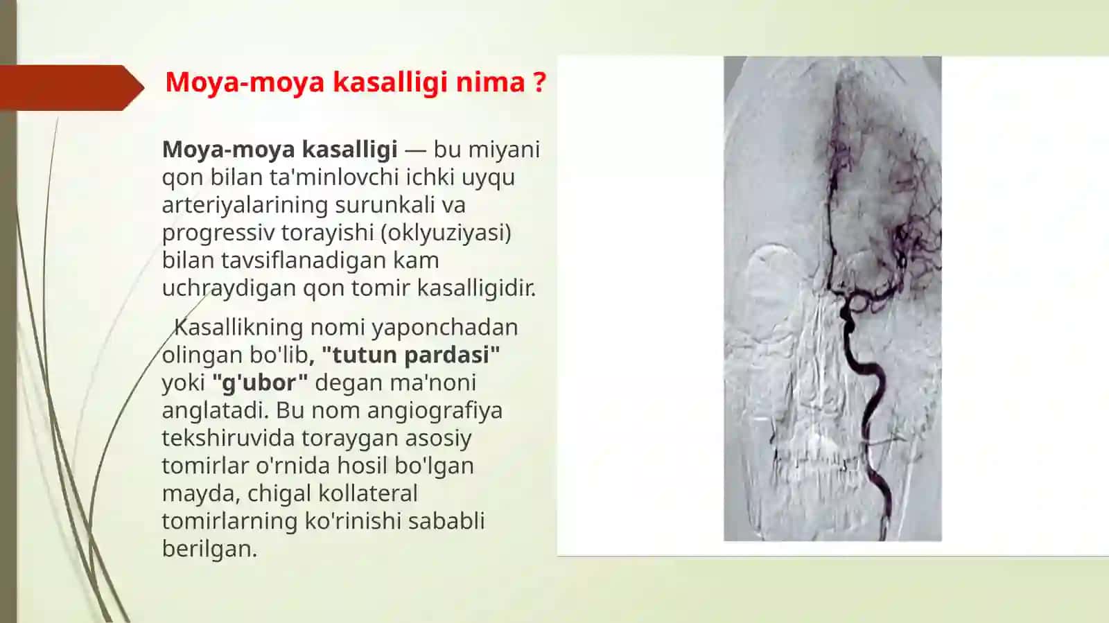 Moya-moyakasalligi 2
