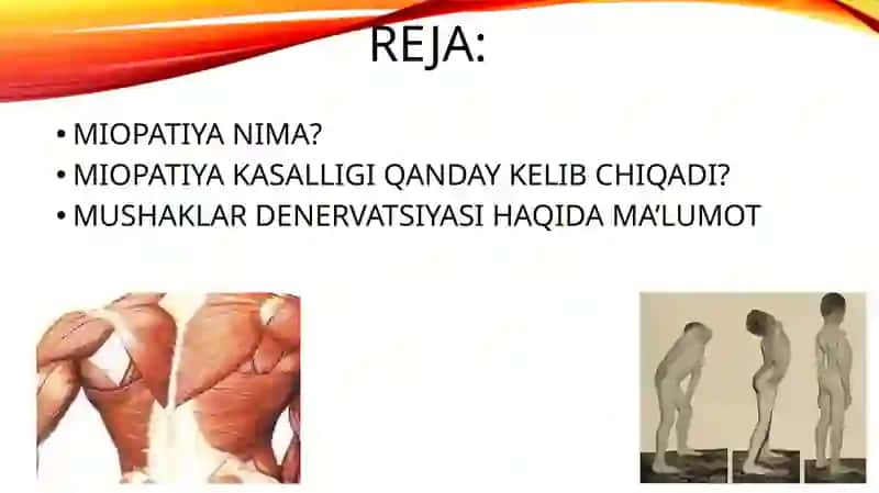 MIOPATIYALAR 2