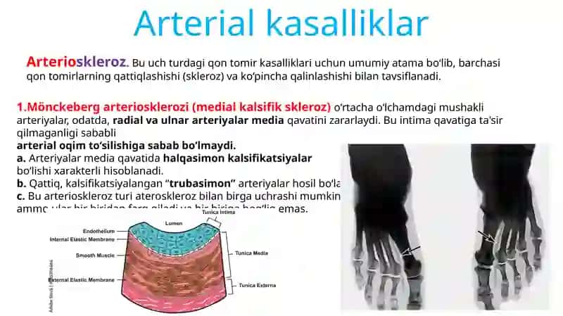 PATOLOGIYA Qontomirkasalliklari Leksiya 2