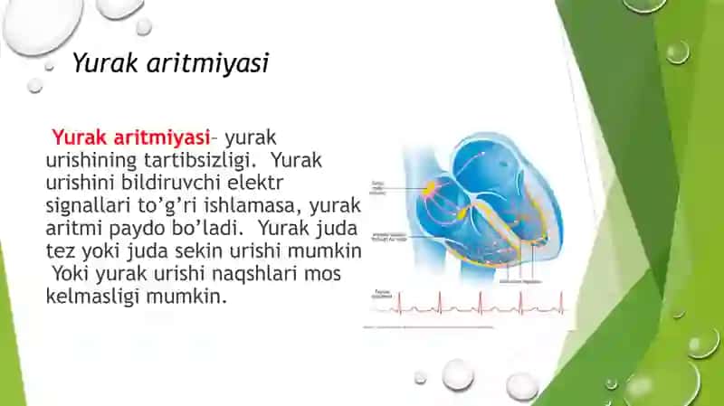 YurakaritmiyalariEKG diagnostikasi 2