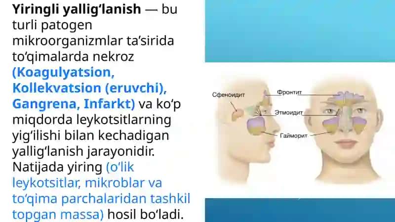 Yiringli yallig‘lanish jarayonlarini keltirib chiqaruvchi mikroorganizmlar 2