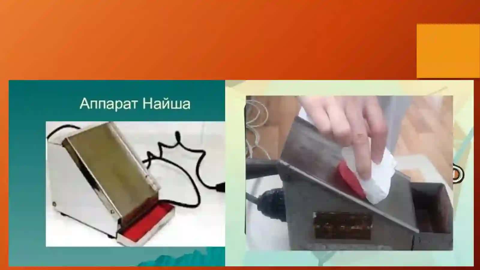 Sun’iy tishlarni tanlash. Sun’iy tishlarni terishdagi anatomik mo’ljallar 2