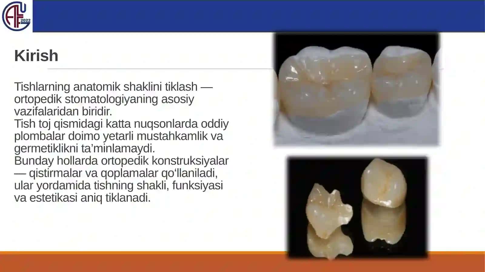 Tishlarning anatomik shaklini tiklaydigan protez turlari 2