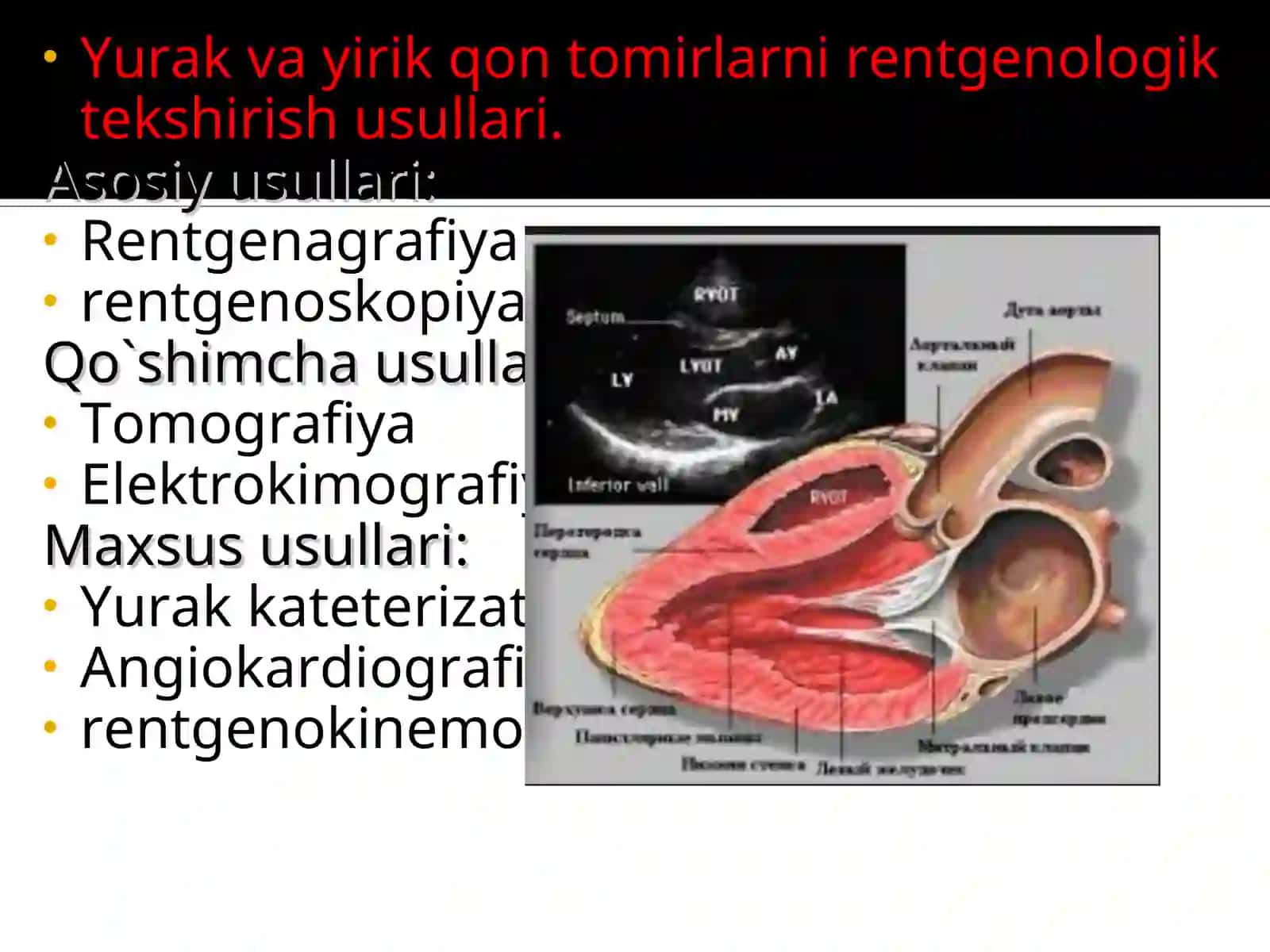 Yurak va yirik qon tomirlarni rentgenologik tekshirish usullari 2