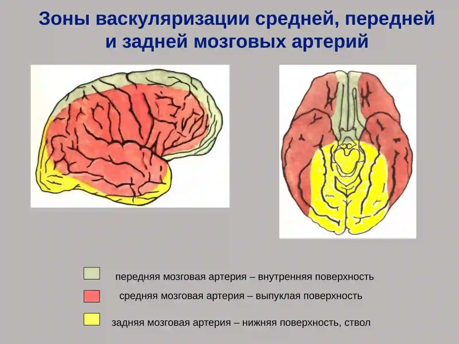 Острые нарушения мозгового кровообращения 2