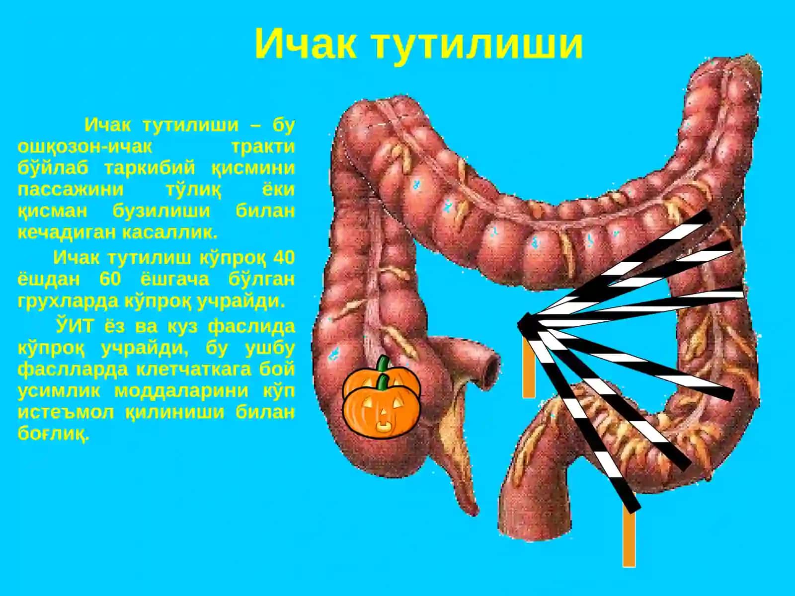 Ўткиричак тутилиши, клиника, ташхис куйиш, киёслама ташхис куйиш 2