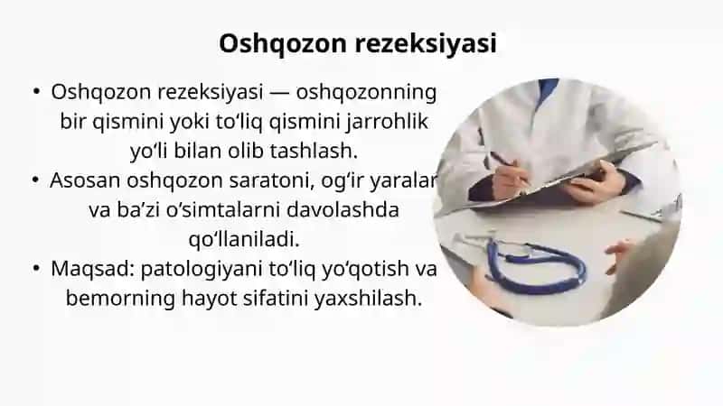 Oshqozon rezeksiyasi 2